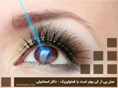 آر اف بهتر است یا هایفو